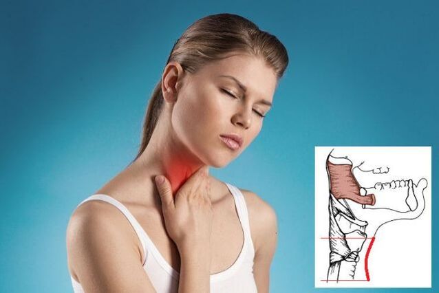 dolor de garganta con osteocondrosis cervical