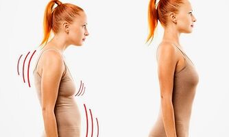 Las razones para el desarrollo de la osteocondrosis cervical