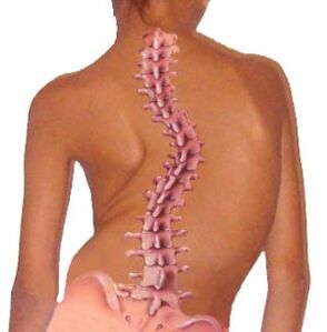 La curvatura de la columna conduce a la osteocondrosis