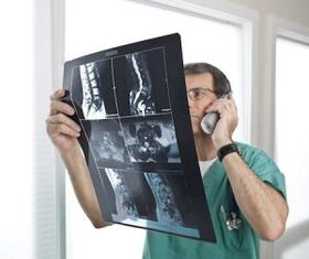Mielografía para el diagnóstico de osteocondrosis y hernias intervertebrales.