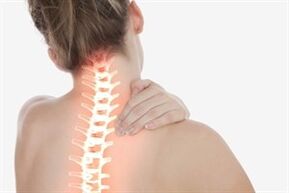 Osteocondrosis cervical en una mujer.